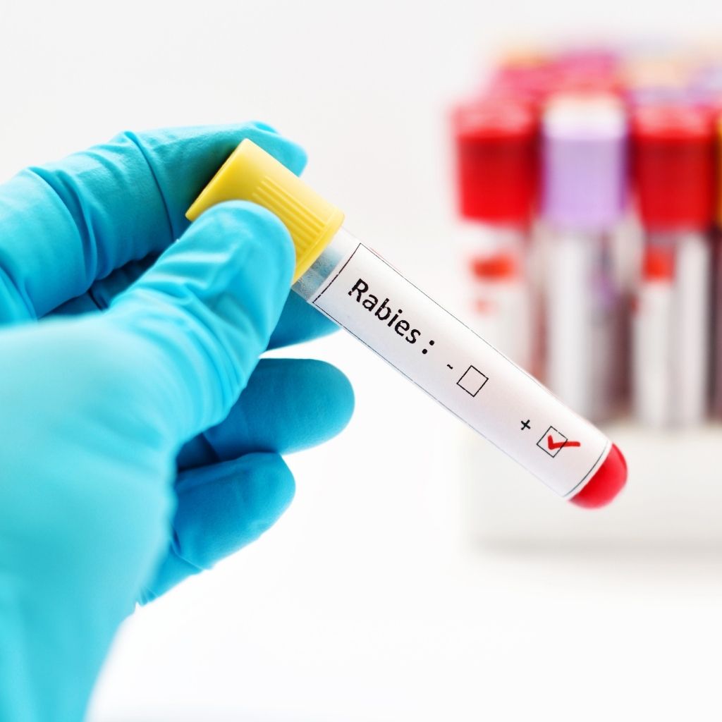 Rabies Testing for Animal Bite